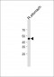 MLNR Antibody (C-term)
